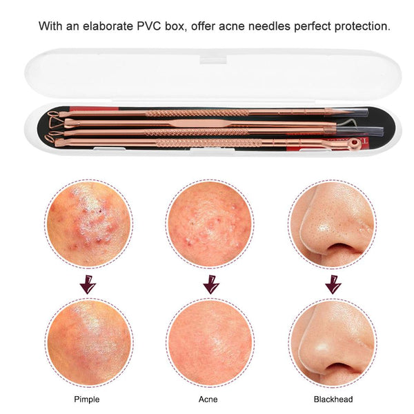 Acne Needle Remover