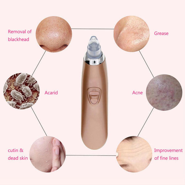 Electric Pores Cleaner