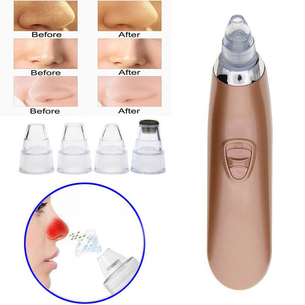 Electric Pores Cleaner