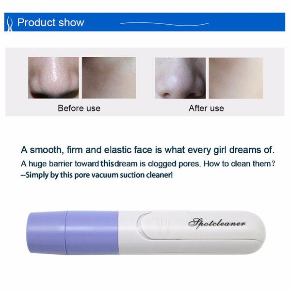 Blackheads Sucker Remover